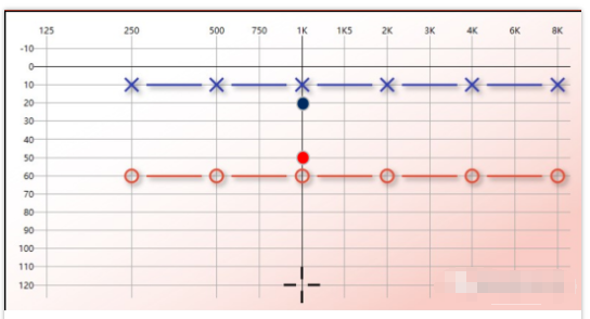 【聽(tīng)力科普】讓偽聾無(wú)所遁形(圖3) 【聽(tīng)力科普】讓偽聾無(wú)所遁形(圖3)