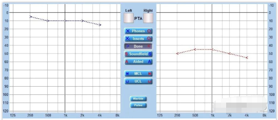 【聽(tīng)力科普】讓偽聾無(wú)所遁形(圖2) 【聽(tīng)力科普】讓偽聾無(wú)所遁形(圖2)