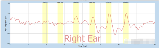 【聽(tīng)力科普】讓偽聾無(wú)所遁形(圖5) 【聽(tīng)力科普】讓偽聾無(wú)所遁形(圖5)